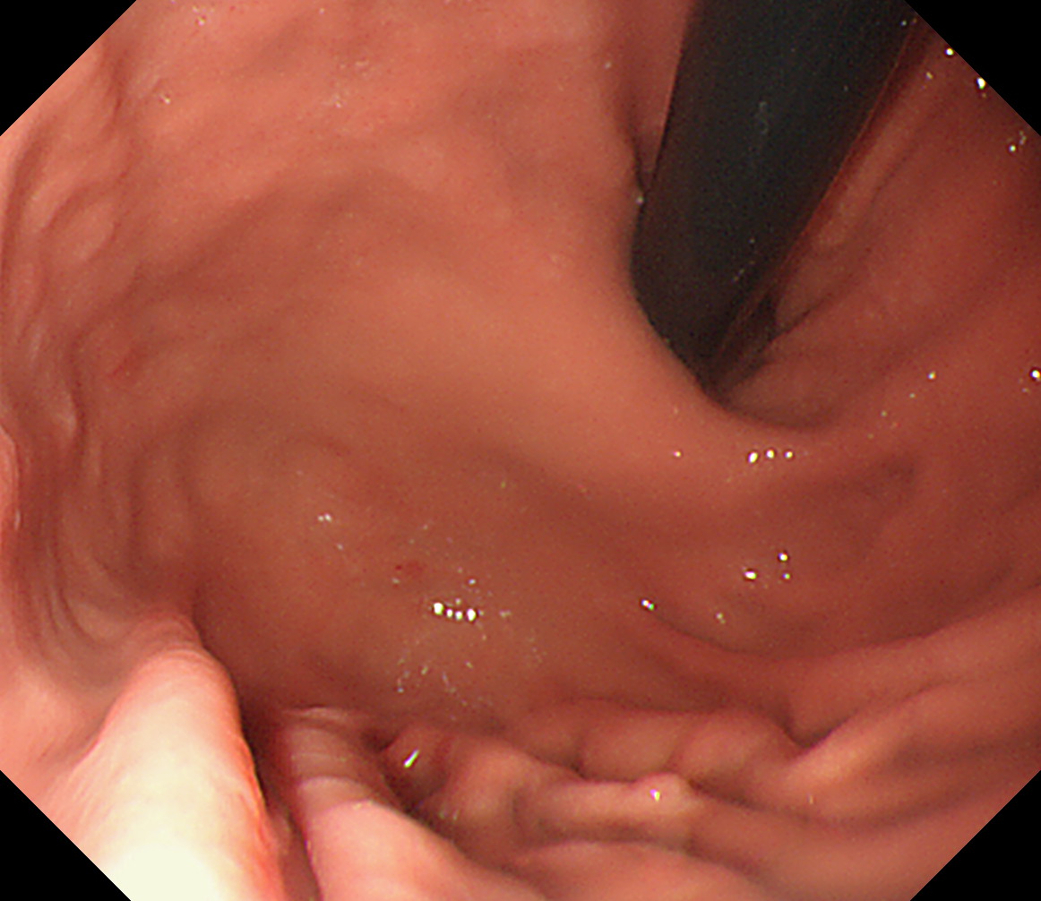 �u⃕���^(����)